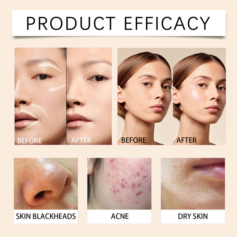 🎁2025 Kuumat myynnit💖Kosteuttava CC-voide