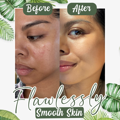 Kuuma myynti -Syväpuhdistava vihreä tee naamio