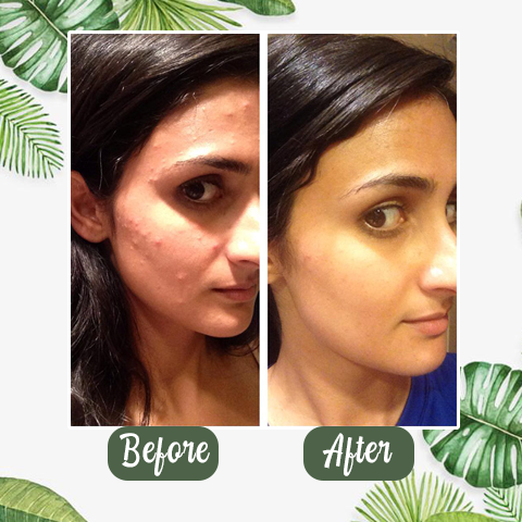 Kuuma myynti -Syväpuhdistava vihreä tee naamio